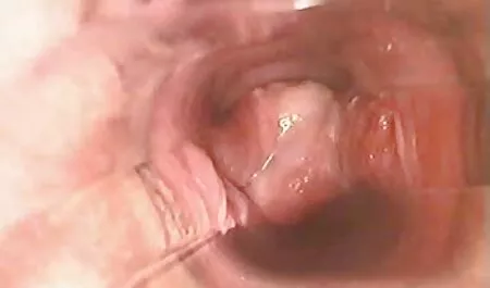 Punapää vuohi balzac katso ilmaista pornoa tupakointi punajuuret